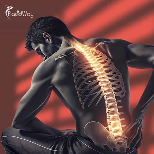 Spine Arthritis Stem Cell Therapy in Mexico for Patients from Brazil Wanting to Move Without Pain